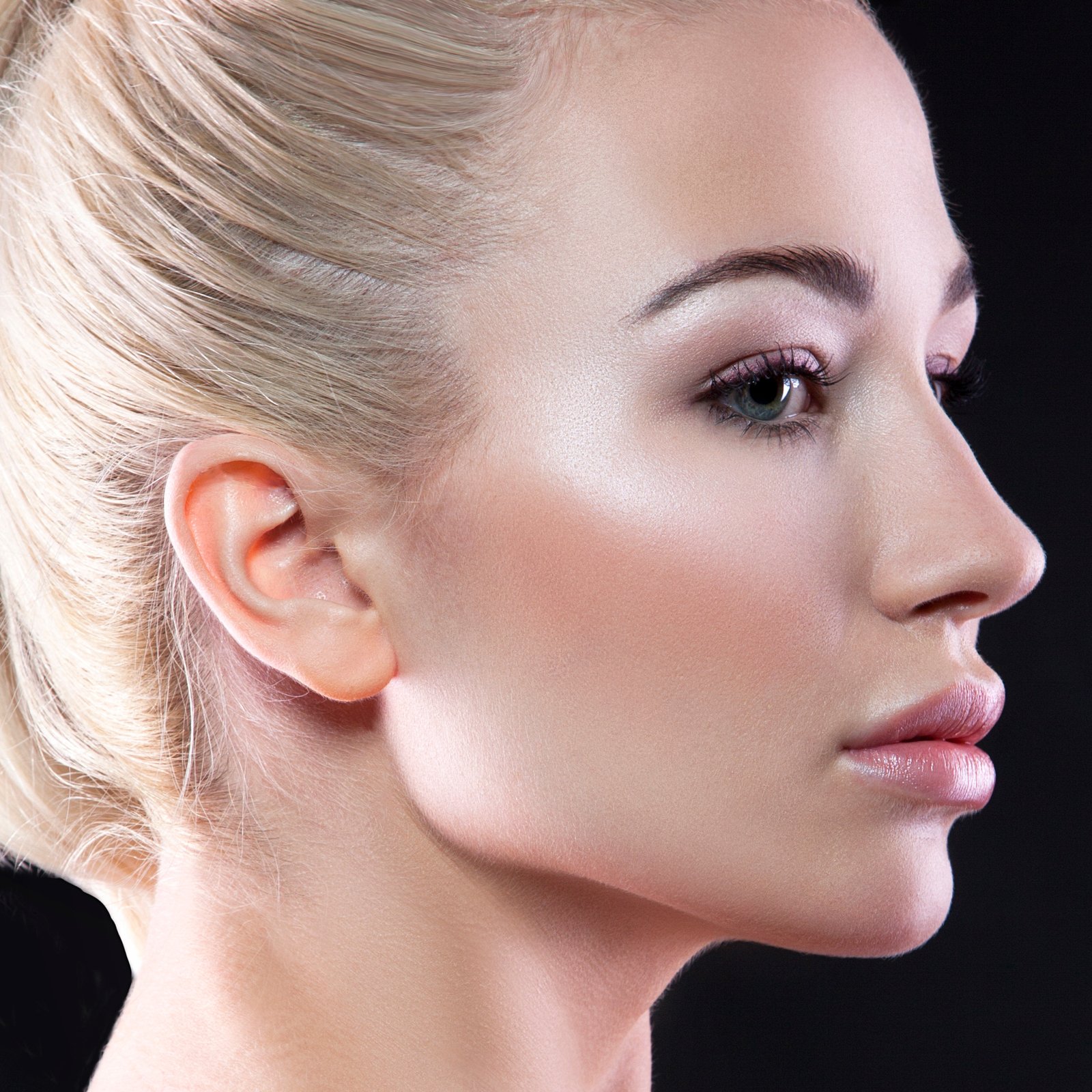Jawline contouring non-surgical filler result at Couture Dermatology Beverly Hills