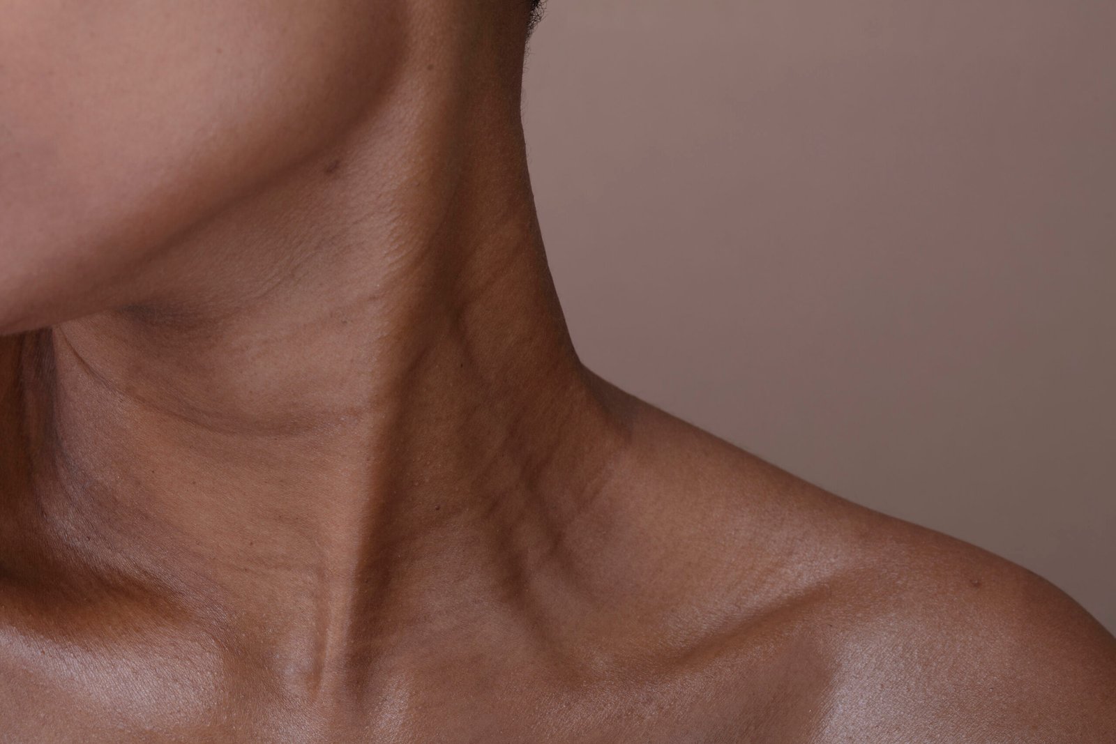 Close-up of a person's neck and collarbone after non-surgical neck lift at Couture Dermatology