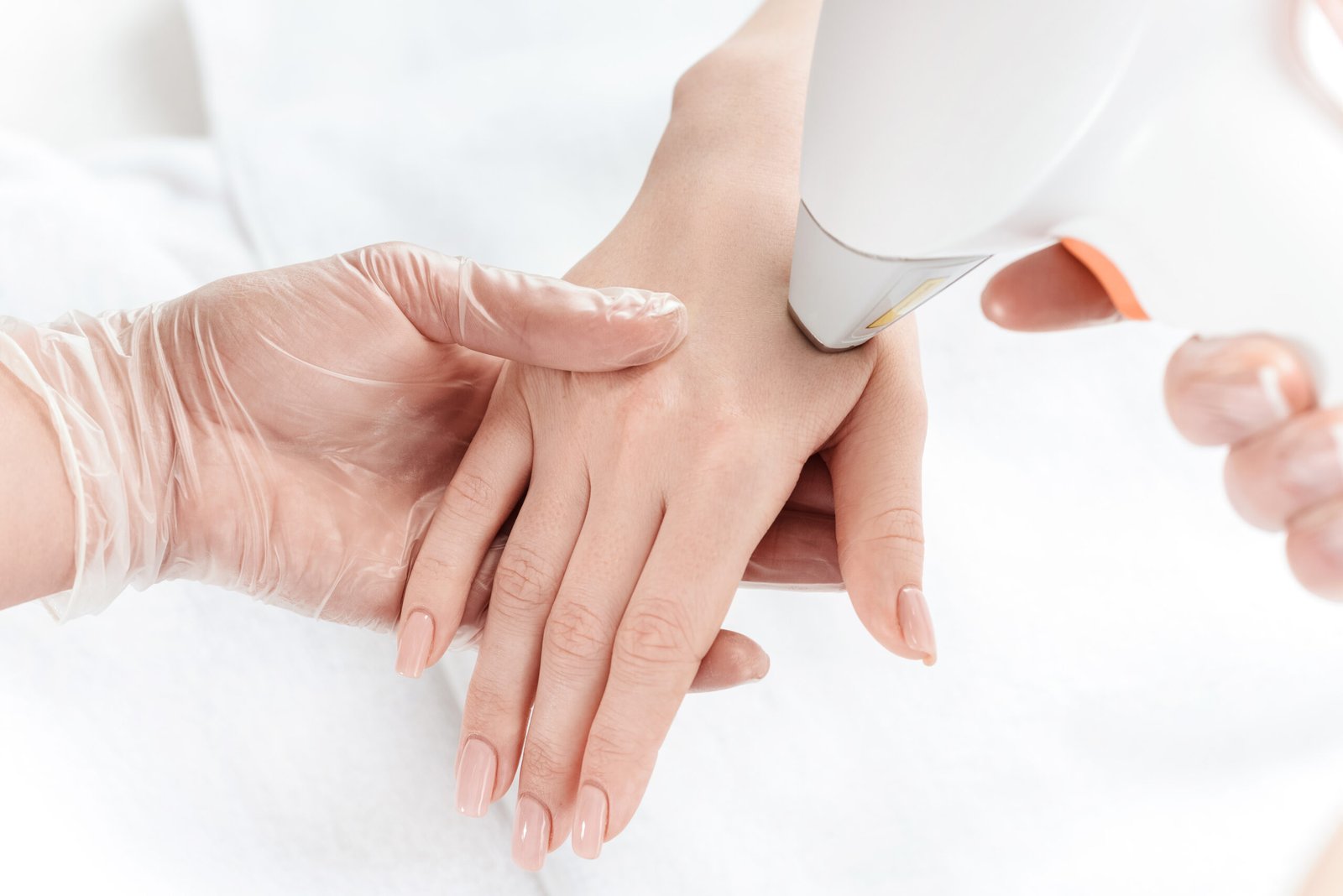 Close-up partial view of woman receiving laser skin treatment on hands at Couture Dermatology
