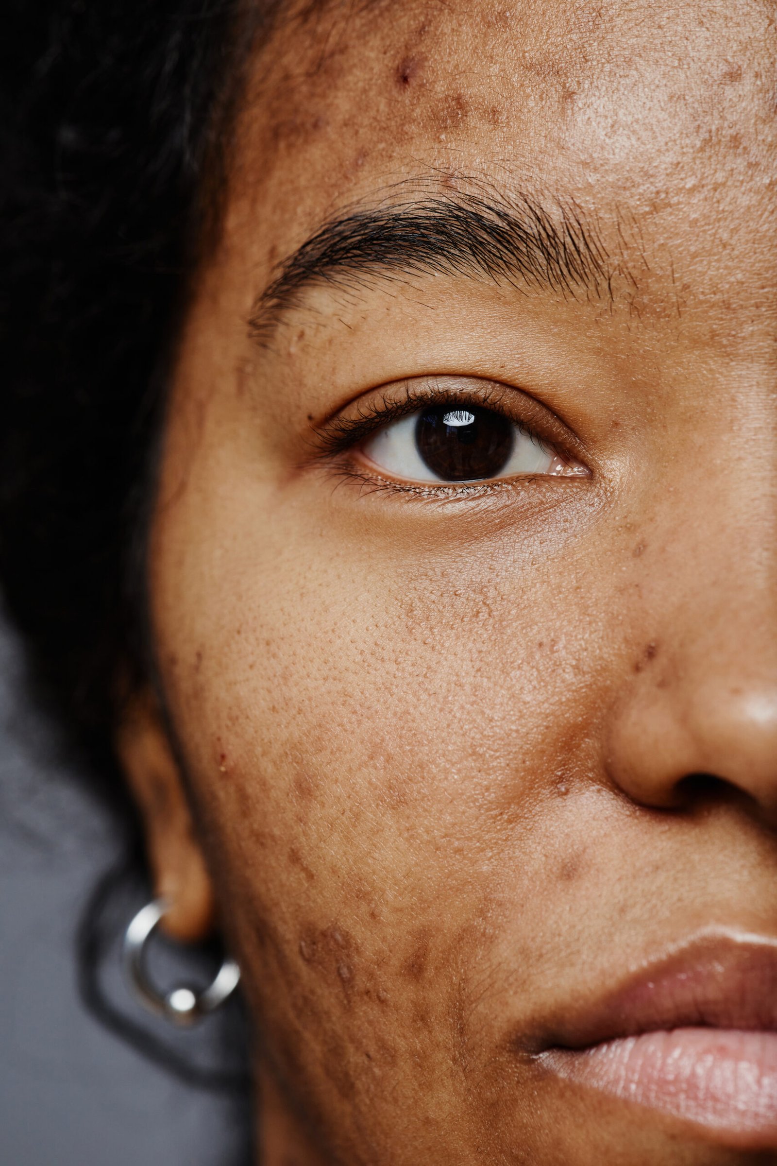 Close-up of Black woman with clear, even skin at Couture Dermatology