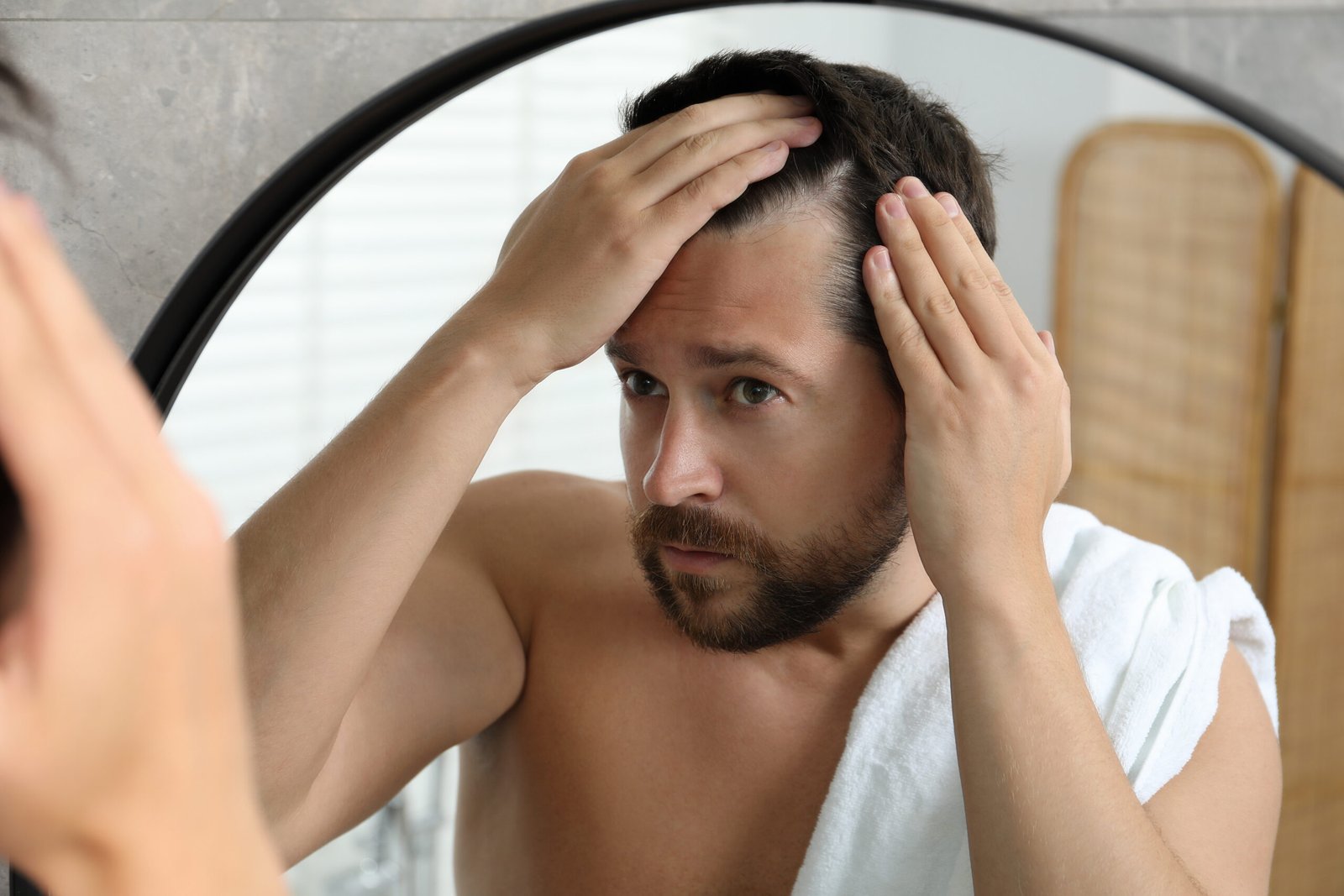 Man examining hair loss in mirror at Couture Dermatology Beverly Hills