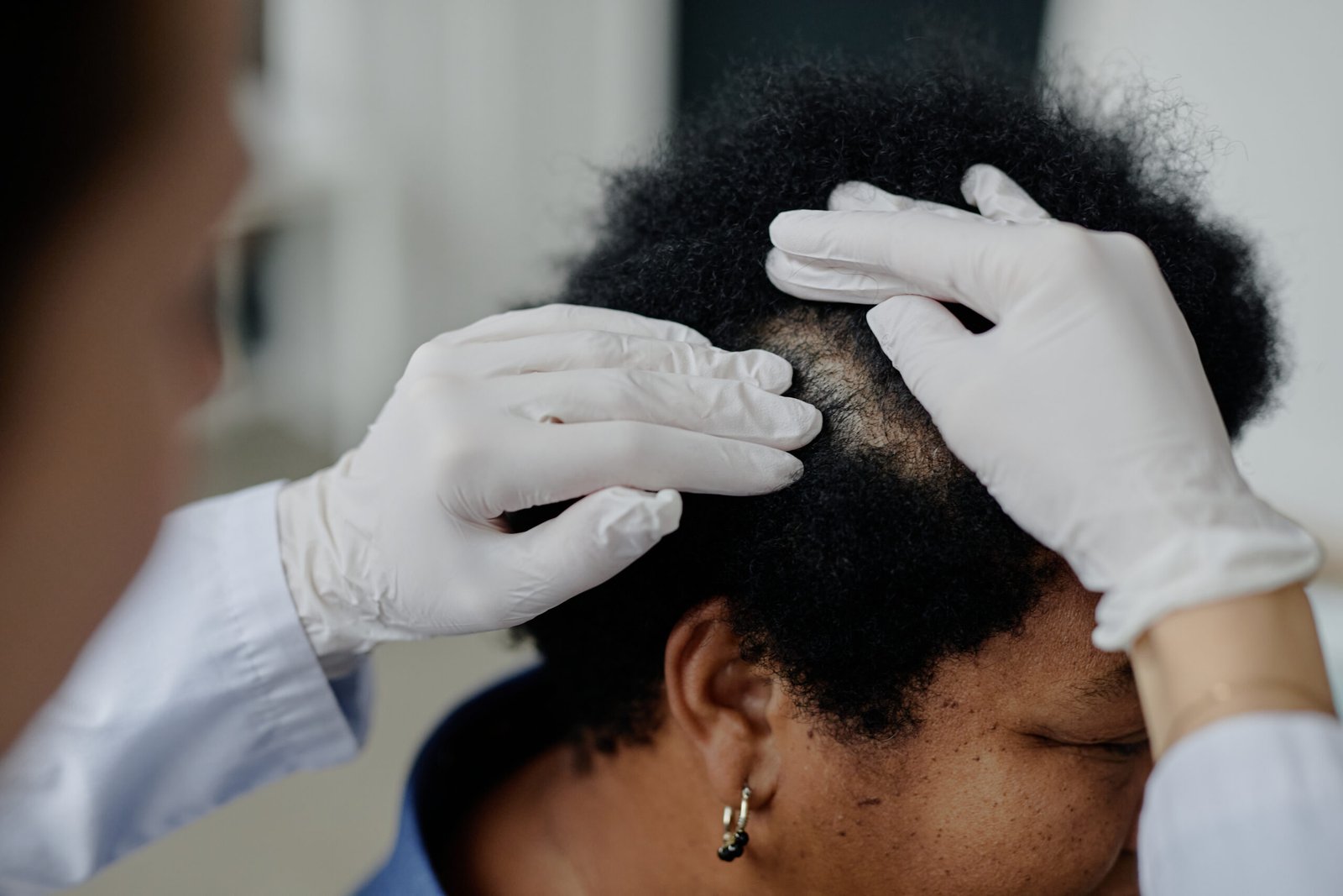 Dermatologist examining patient scalp for hair loss at Couture Dermatology Beverly Hills