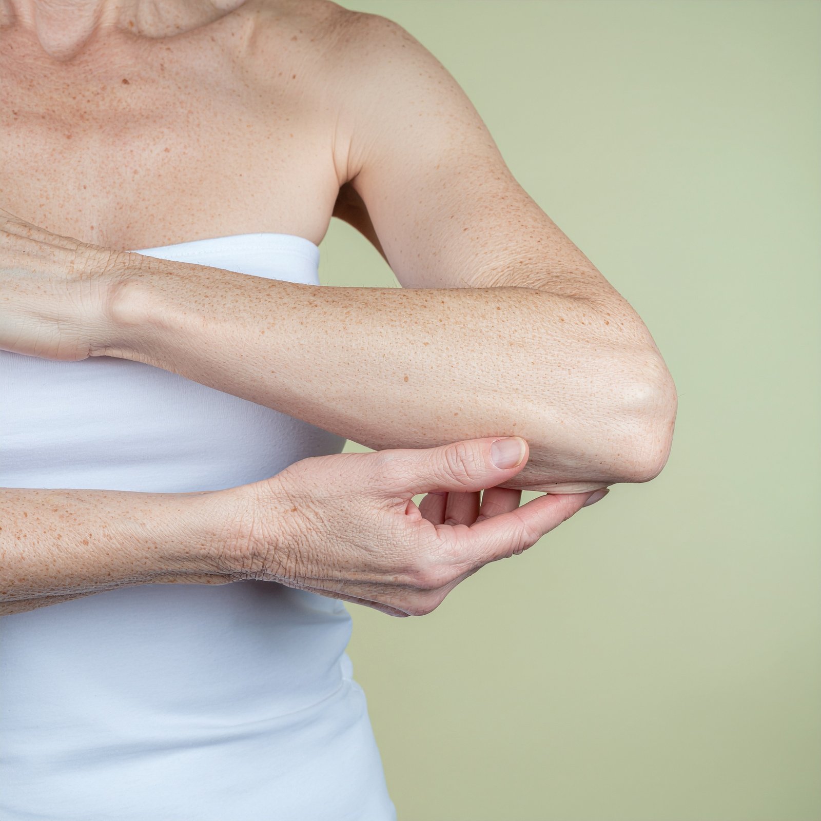 Man scratching inflamed skin, illustrating eczema symptoms at Couture Dermatology
